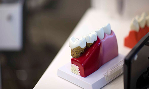 O QUE É ENDODONTIA?