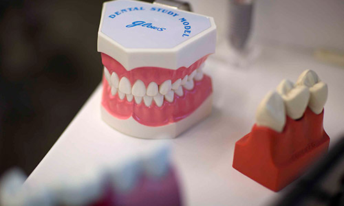 O QUE SÃO COROAS E PONTES?